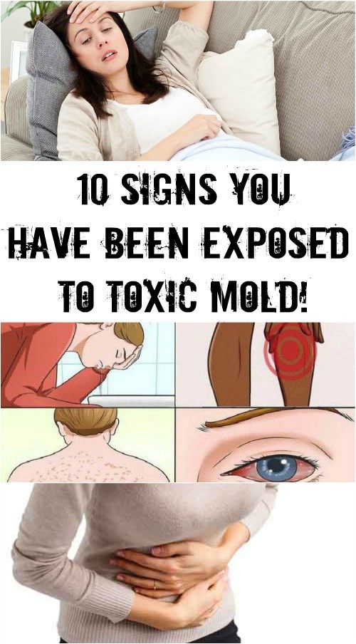 10 SIGNS YOU HAVE BEEN EXPOSED TO TOXIC MOLD!