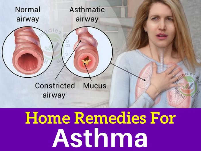 12 Proven Home Remedies for Asthma