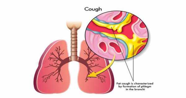 5 Methods to Stop Coughing Fast Without Medicine