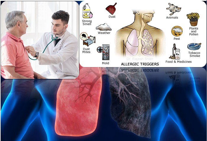 Asthma a Chronic Disease