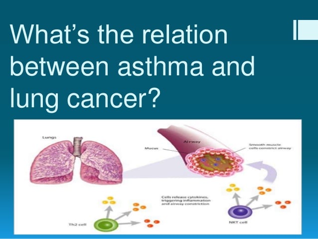 Asthma And Lung Cancer