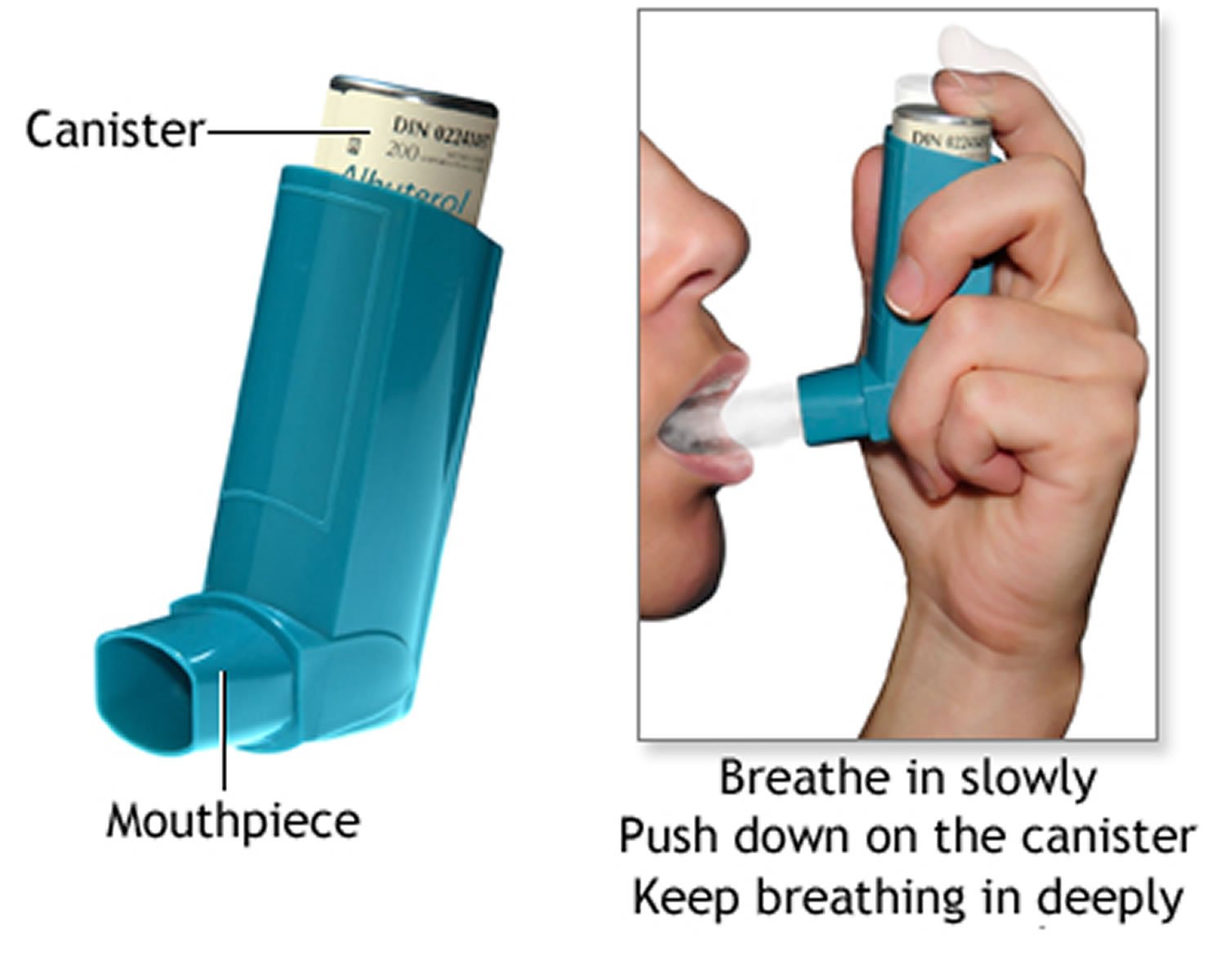 Asthma Attack Causes, Allergy, Triggers