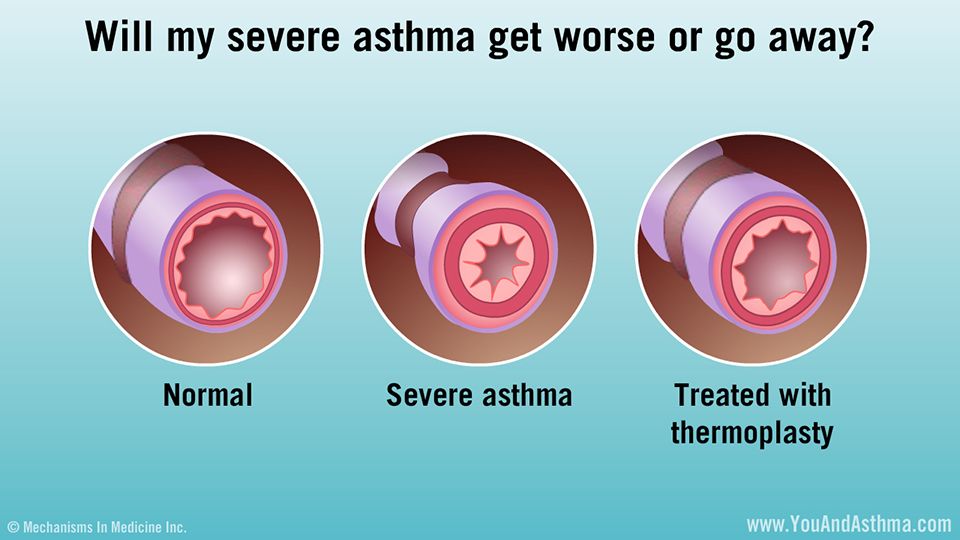 Asthma Is Getting Worse