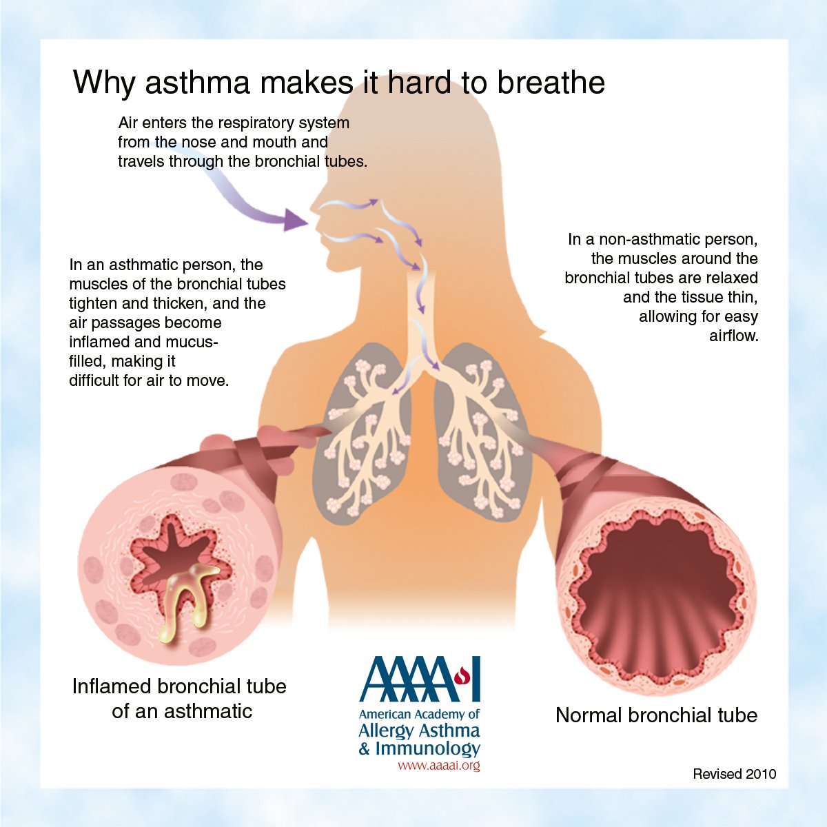Asthma Library