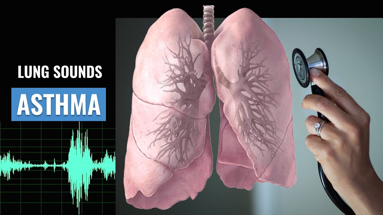 Asthma Lung sound