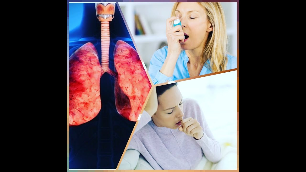Asthma Treatment and Wet Cough Cure Permanently without ...