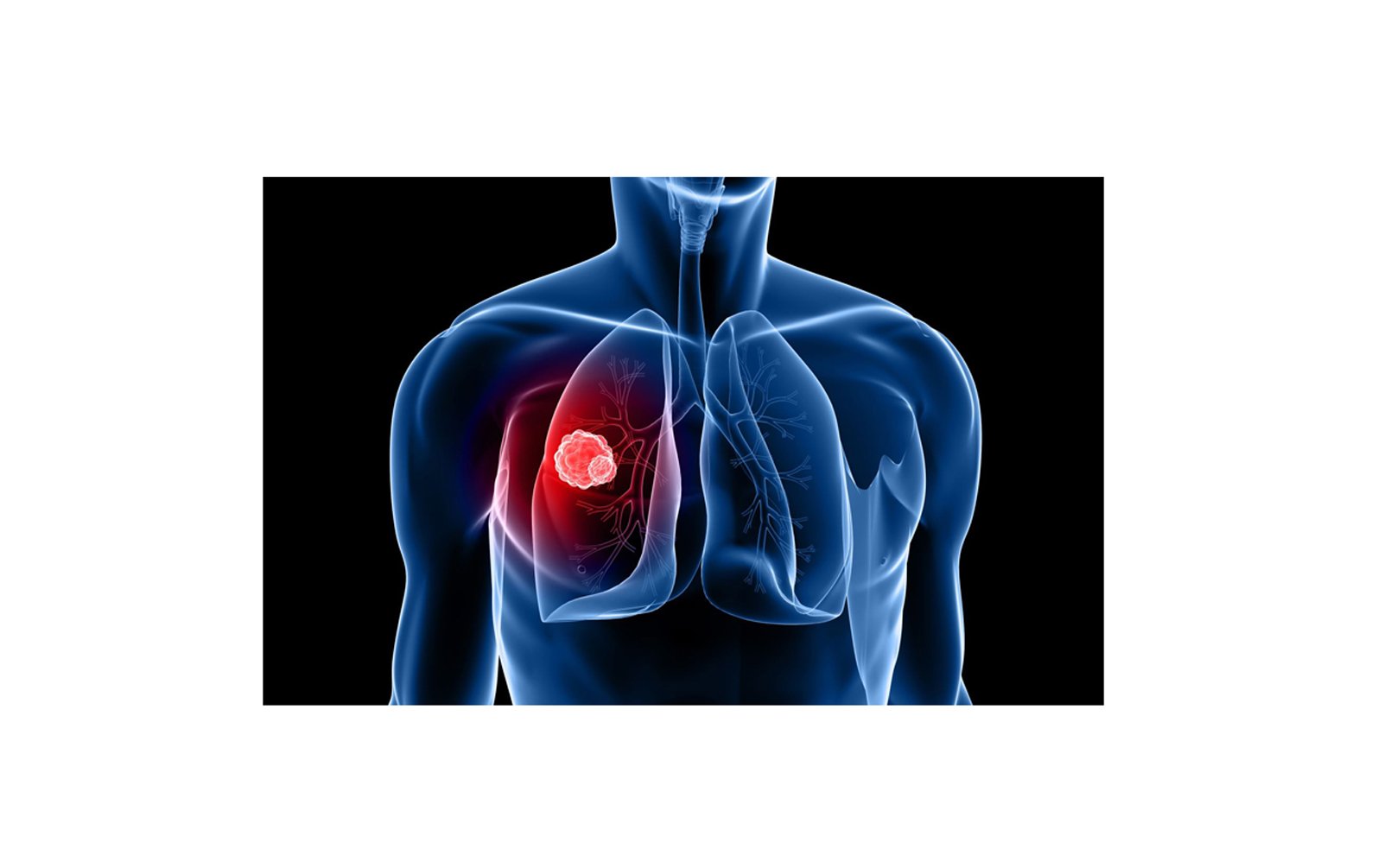 Best Lung Specialist in Mumbai,Mulund and Thane