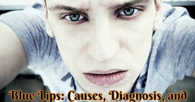 Blue Lips: Causes, Diagnosis, and Treatment