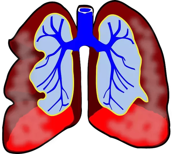 Can too much albuterol cause increased asthma?