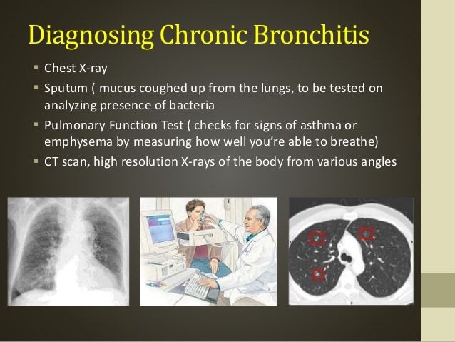 Chronic bronchitis &  emphysema