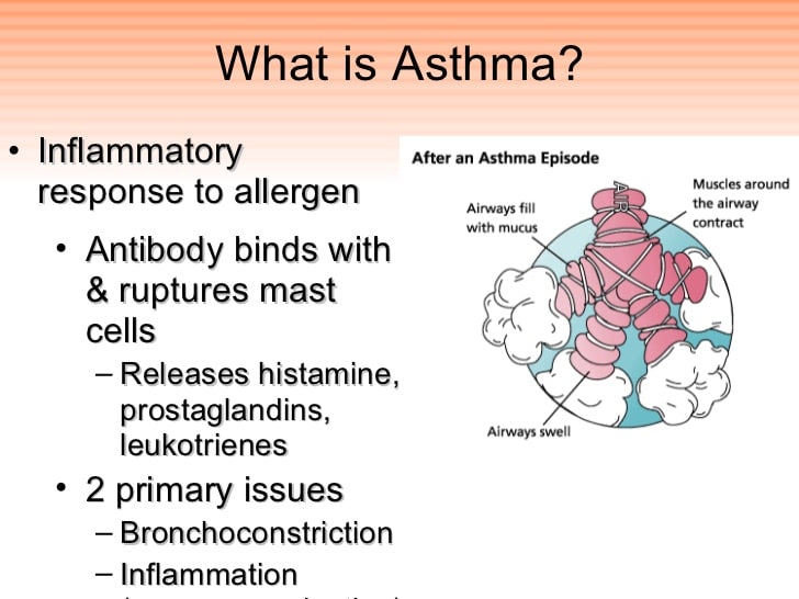 Doxophylline and asthma
