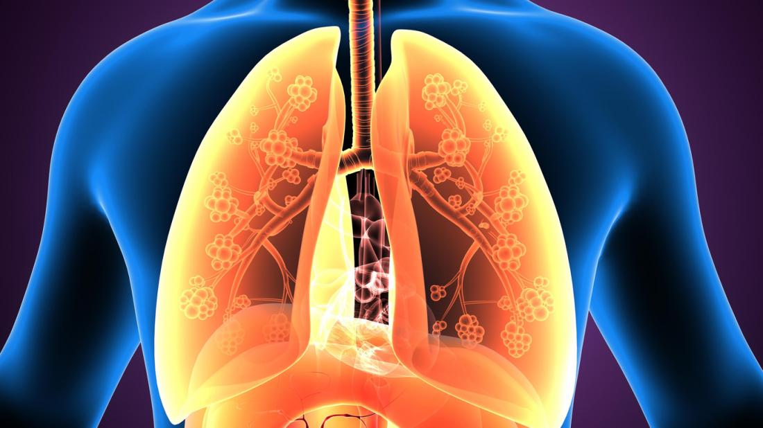 Eosinophilic asthma: Symptoms, diagnosis, and treatment