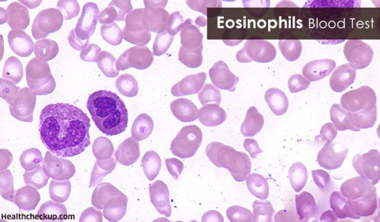 Eosinophils Blood Test Procedure