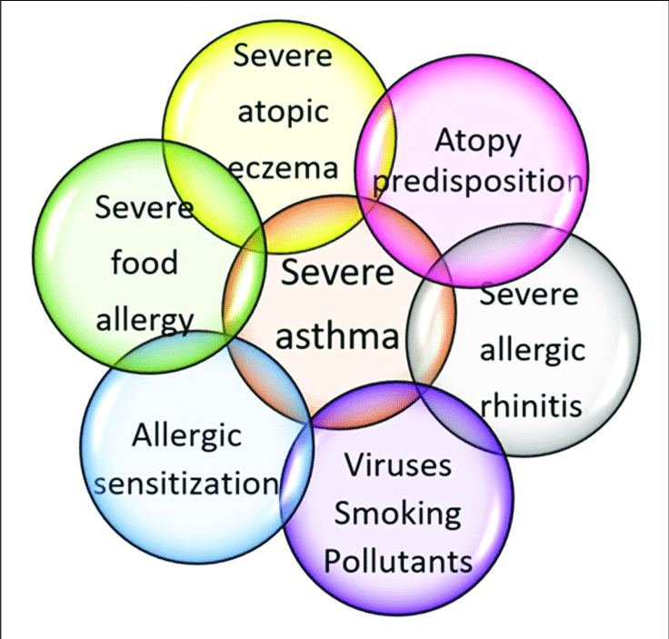 factors contributing to severe asthma development in