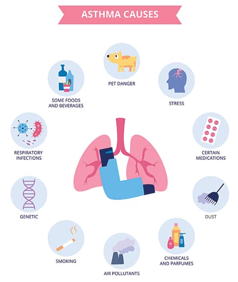 General Information about Asthma
