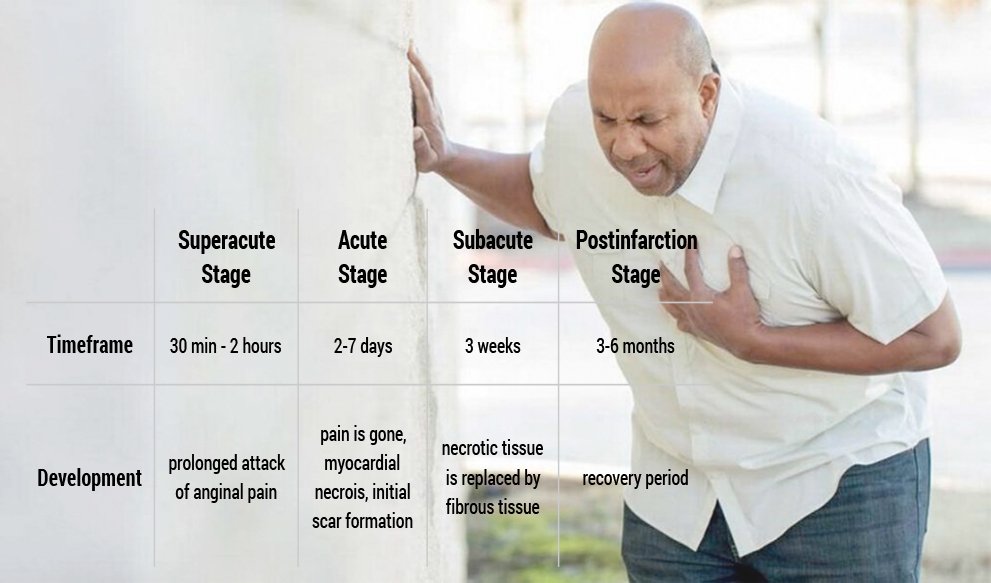 How Long Does Chest Pain Last After Anxiety Attack