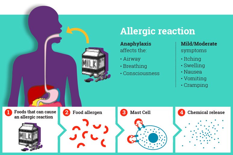Information about Anaphylaxis for pharmacists
