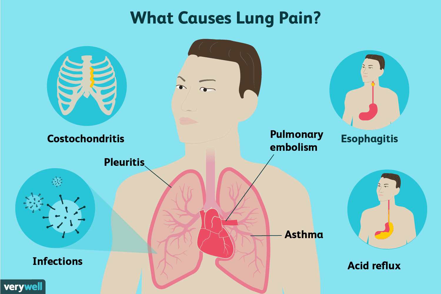 Lung Pain: Causes, Treatment, and When to See a Doctor