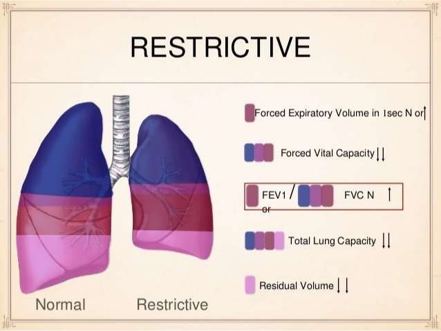obstructive &  restrictive lung disease