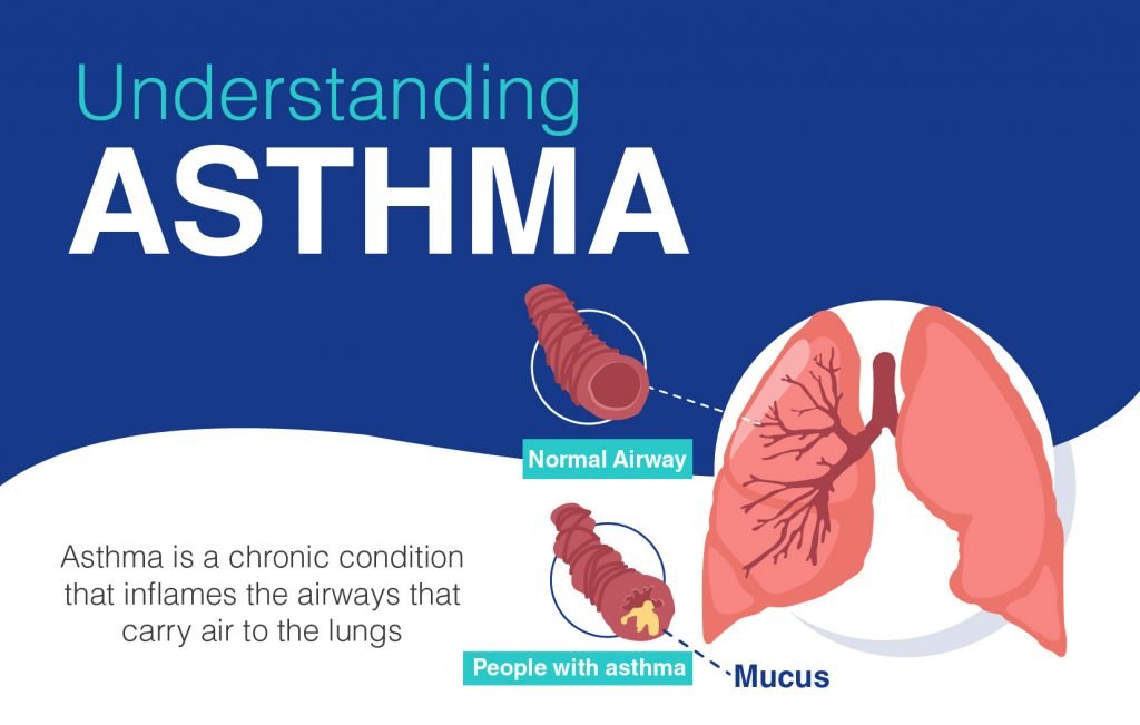 Overview of Asthma: Causes, Symptoms,Types, Risk Factors ...