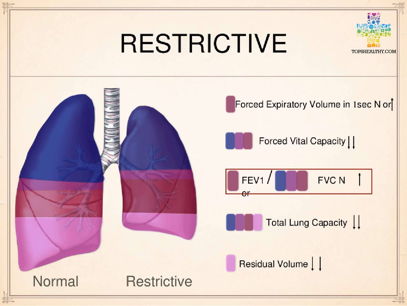 Restrictive Lung Disease and the ...