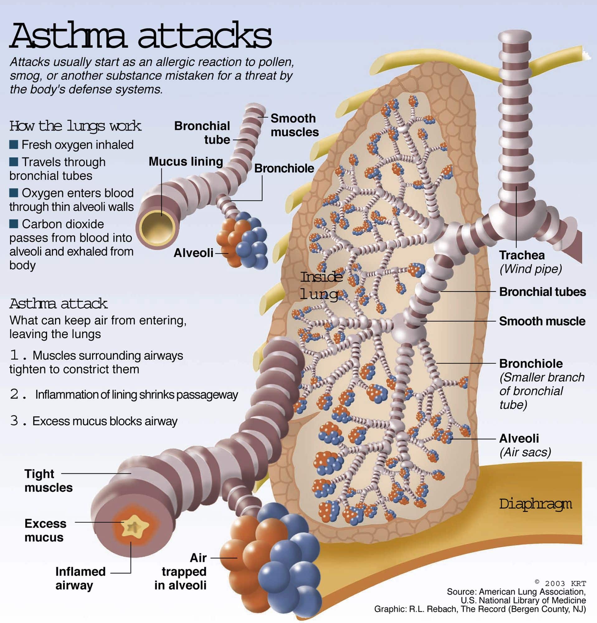 Seeking Advice On Dealing With Asthma? Look Below For Some Great Tips ...