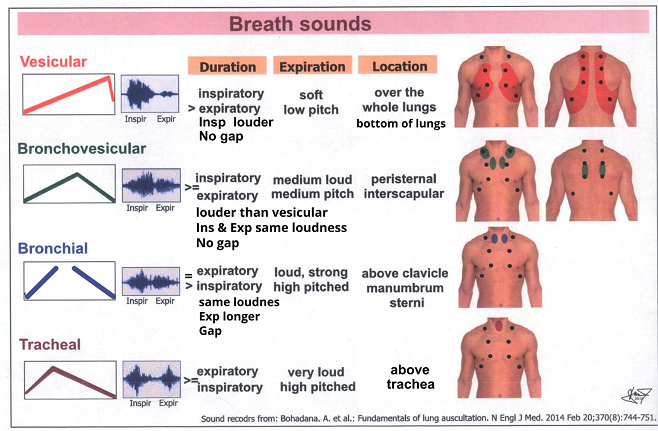 Tracheal breath sounds are heard over the trachea. These ...