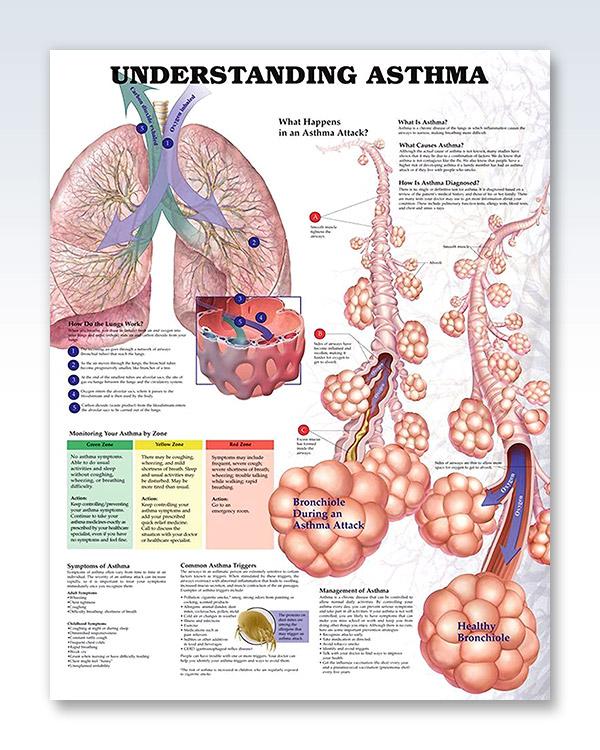 Understanding Asthma 20x26 Anatomy Poster