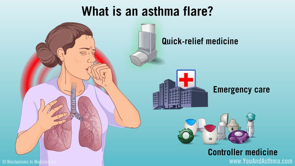 What is an asthma flare? An asthma flare is when symptoms get worse ...