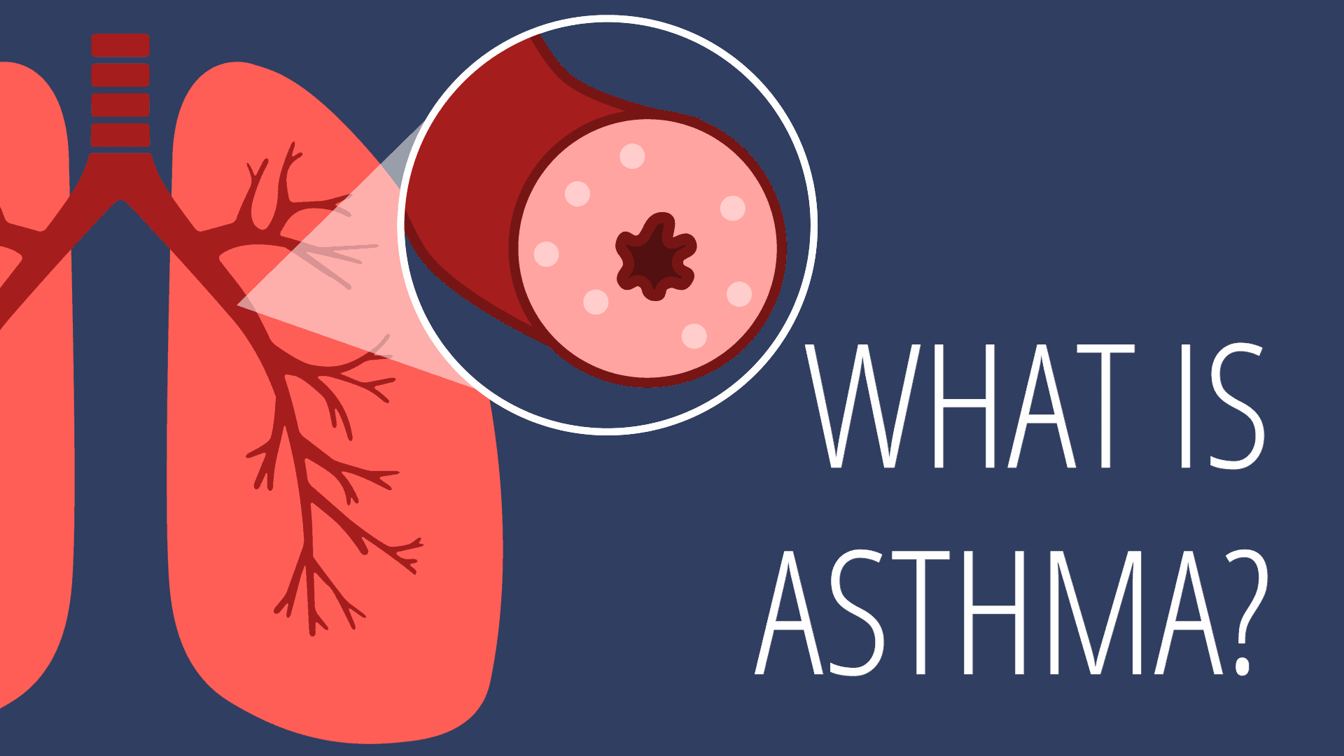 What Is Asthma?